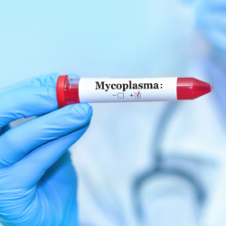 Ensuring Rigorous Validation in a GMP Environment 